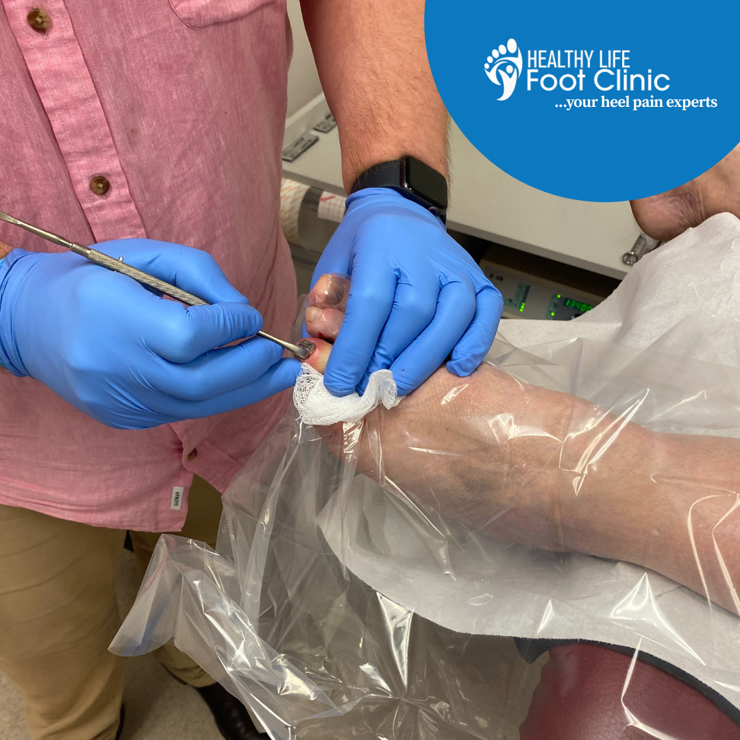 Podiatrist performing surgery