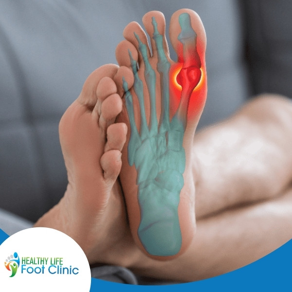 Adelaide Podiatrist, Mark Heard, Treats a Patient with Sesamoiditis